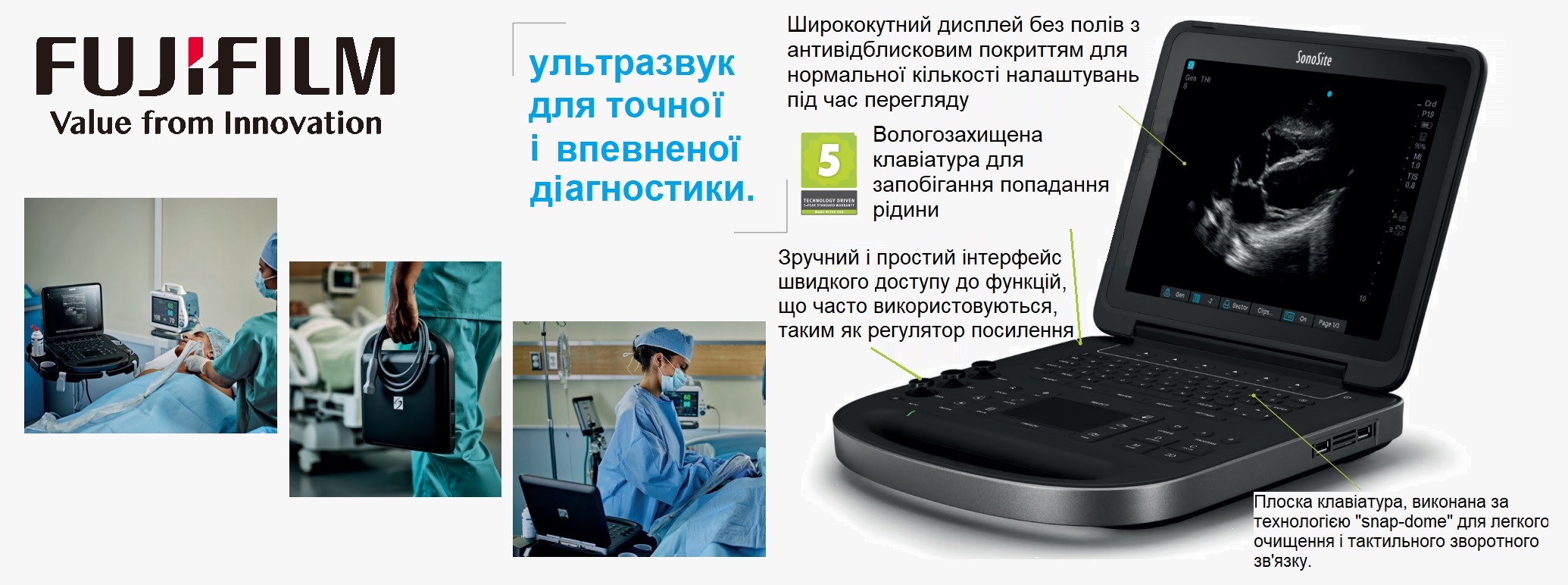 Ультразвукова система SonoSite Edge II